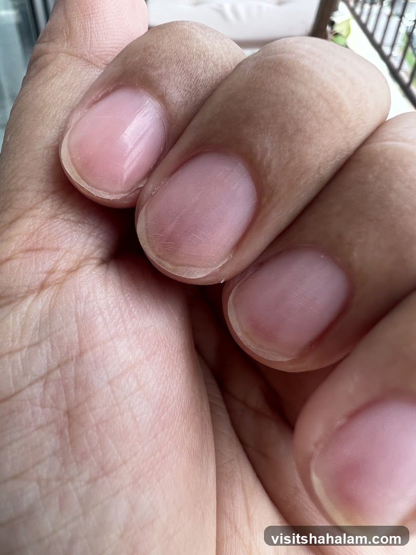 Close-up of fingernails