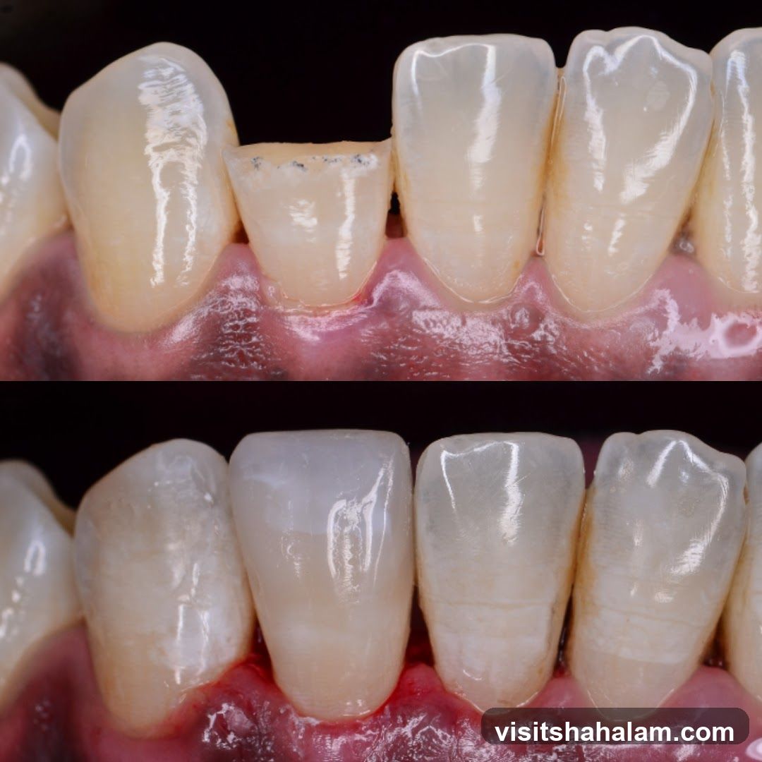 Dental Restoration Comparison