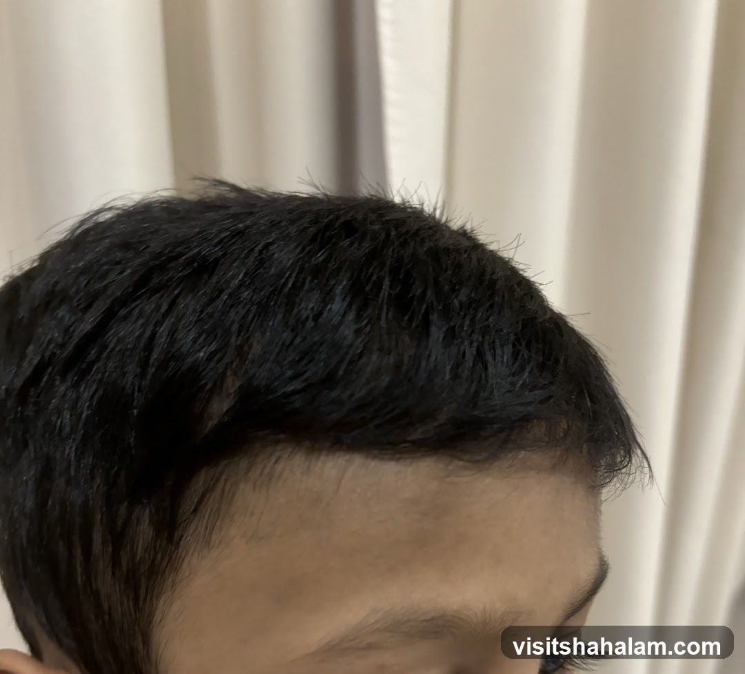 Close-up of a person's hair and forehead