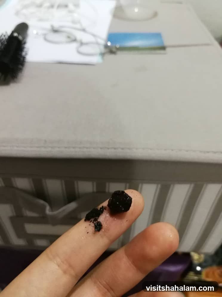 Finger with dark particles