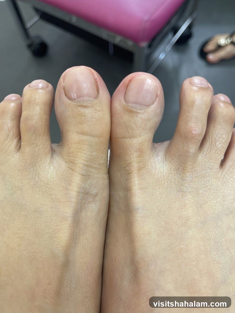 Close-up of Toes