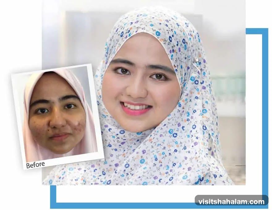 Before and After Skincare Comparison