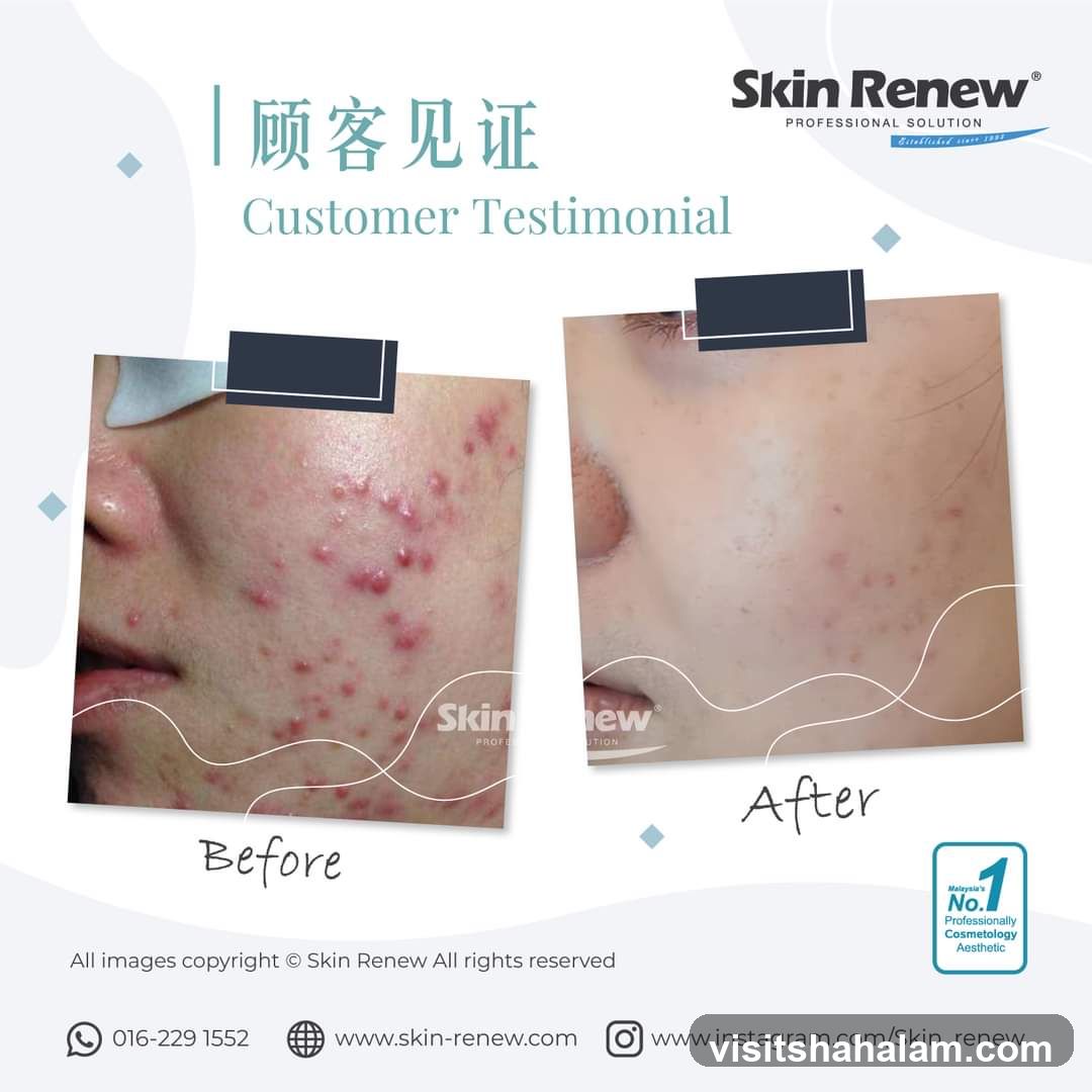 Customer Testimonial