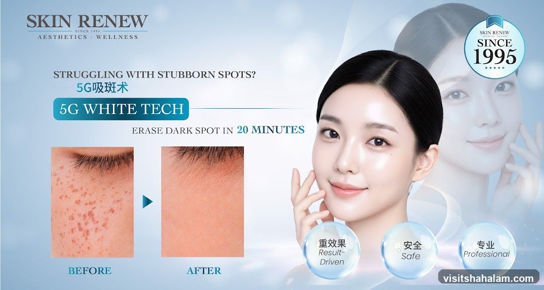 Skin Renew Advertisement