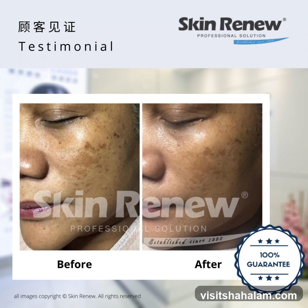 Skin Renew Testimonial