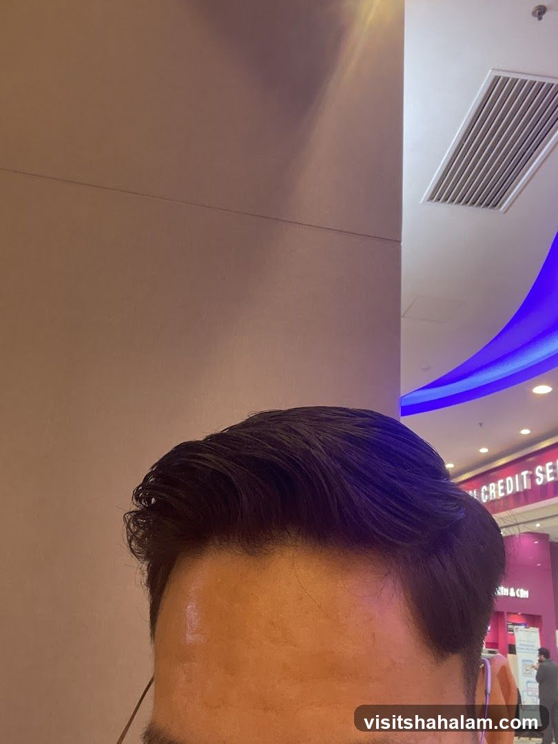 Man's Forehead and Hair