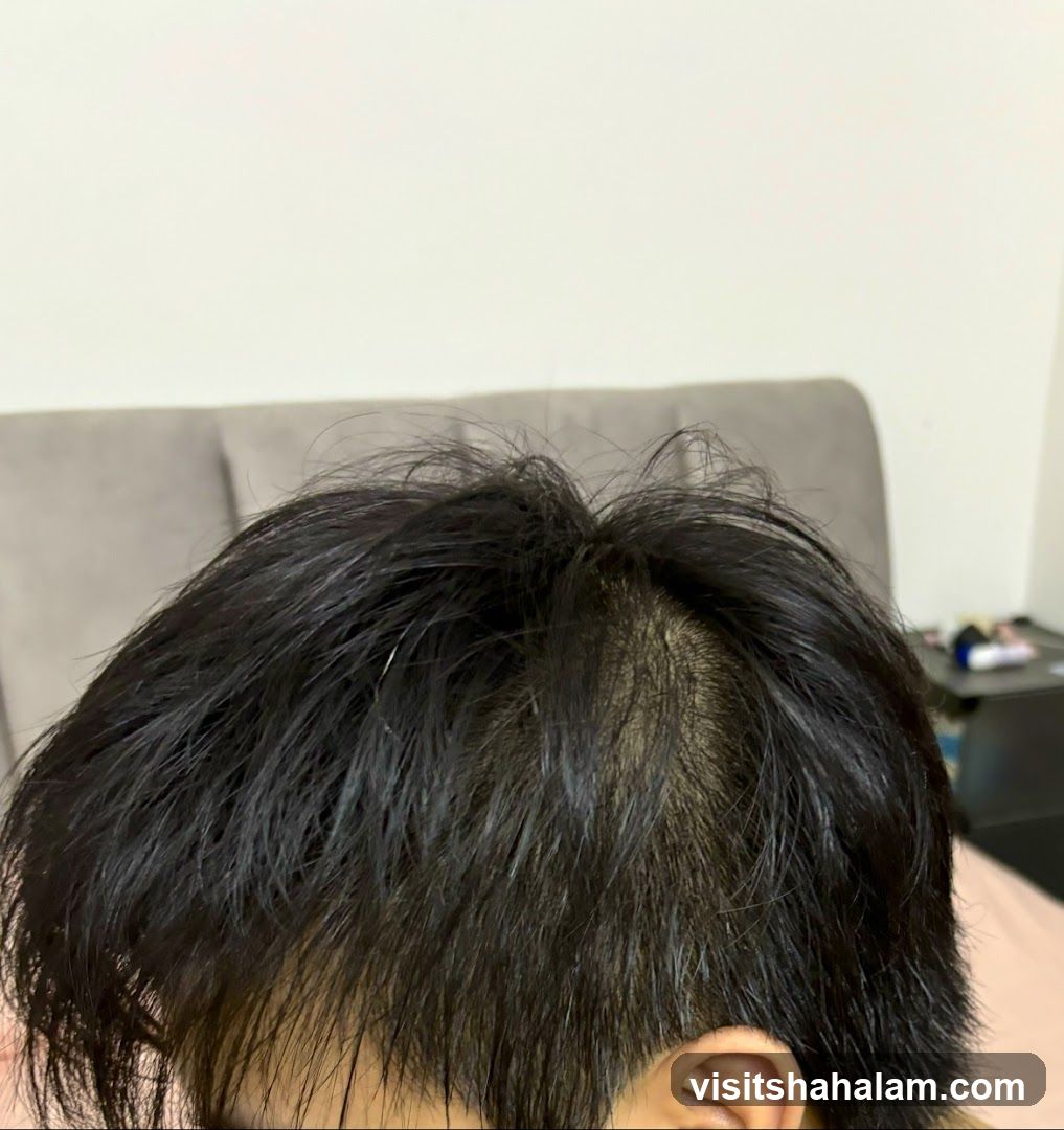 Hairline
