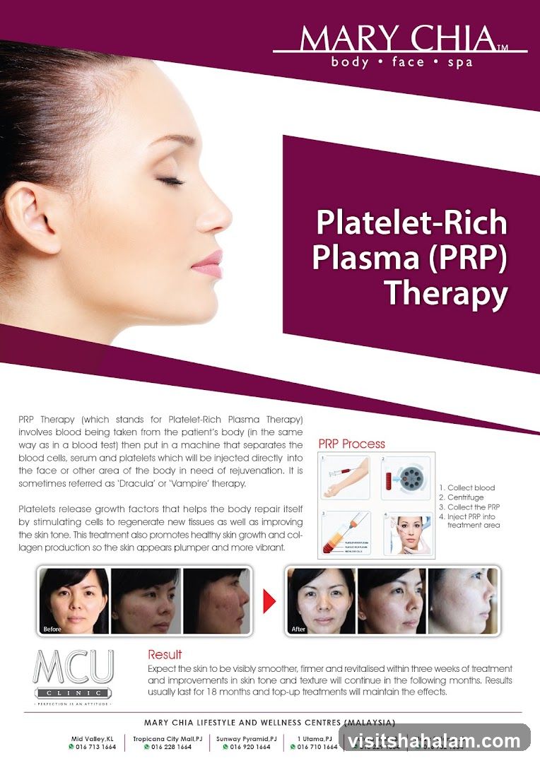 Platelet-Rich Plasma (PRP) Therapy