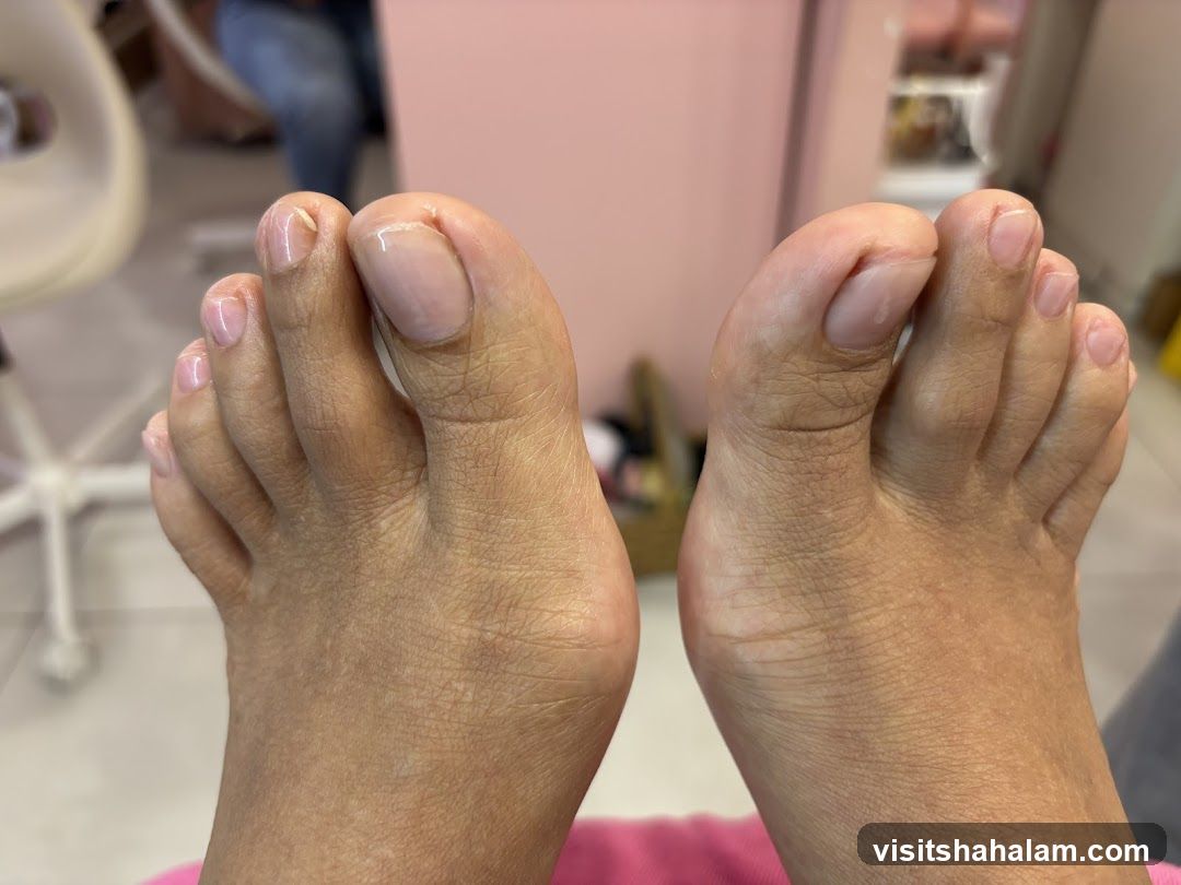 Pedicure